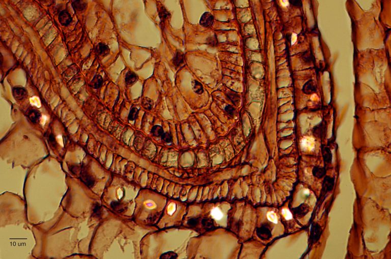 Single crystal formation in the ovary wall of Podophyllum peltatum or Mayapple.  Polarized light microscopy with partially crossed polarisers reveals the structure.  Polycrystalline potassium oxalate is common in botanical structures, but not single crystals.