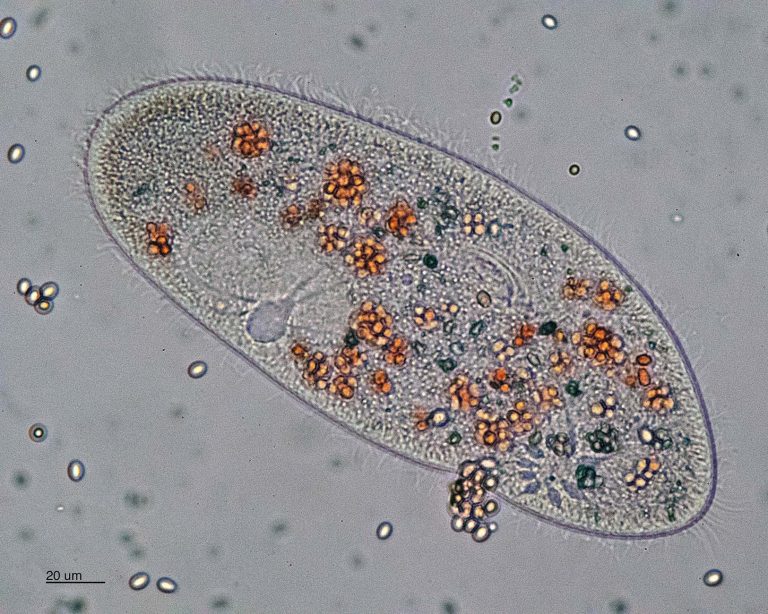 The food vacuoles in this paramecium are stained red after consuming Congo Red stained yeast cells.  Congo red is an acid base indicator transitioning from red to blue around a pH of 3-5.2.  The digestion process results in the acidification of the vacuoles.